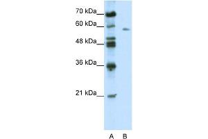WB Suggested Anti-BTBD14A Antibody Titration:  0.