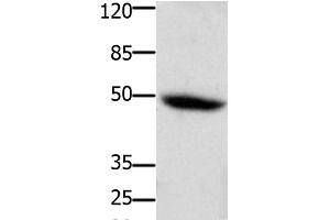 Western Blot analysis of Mouse heart tissue using CD116 Polyclonal Antibody at dilution of 1:400 (CSF2RA anticorps)