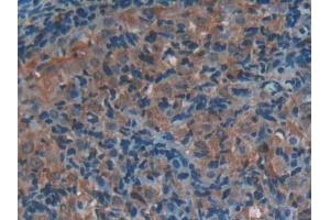 Used in DAB staining on fromalin fixed paraffin- embedded stomach tissue (P-Selectin anticorps  (AA 58-158))