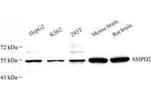 Western blot analysis of nSMase (ABIN7075702) at dilution of 1: 600 (SMPD2 anticorps)
