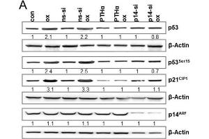 (A) LoVo cells were either exposed to PTHα (30 μM) or transfected with non-specific siRNA (ns-siRNA) or p14ARF specific siRNA.