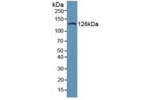 Detection of ITGaD in Human Serum using Polyclonal Antibody to Integrin Alpha D (ITGaD) (ITGAD anticorps  (AA 879-1099))