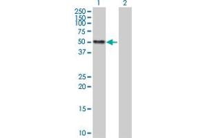 Western Blot analysis of CALR expression in transfected 293T cell line by CALR MaxPab polyclonal antibody. (Calreticulin anticorps  (AA 1-417))