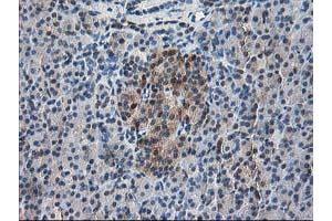 Immunohistochemical staining of paraffin-embedded Human pancreas tissue using anti-RBP1 mouse monoclonal antibody.