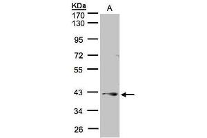 WB Image Sample(30 μg of whole cell lysate) A:A431, 10% SDS PAGE antibody diluted at 1:1000