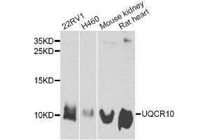 Western blot analysis of extracts of various cell lines, using UQCR10 antibody. (UQCR10 anticorps  (AA 1-63))