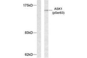 Western Blotting (WB) image for anti-Mitogen-Activated Protein Kinase Kinase Kinase 5 (MAP3K5) (pSer83) antibody (ABIN2888358) (ASK1 anticorps  (pSer83))