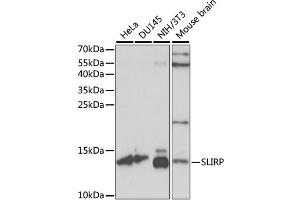Western blot analysis of extracts of various cell lines, using SLIRP antibody. (SLIRP anticorps)