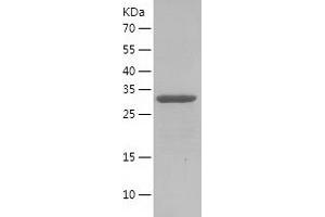 Western Blotting (WB) image for CD81 (CD81) (AA 110-150) protein (His-IF2DI Tag) (ABIN7122215)