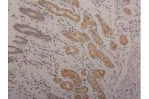 Detection of Arg2 in Human Stomach Tissue using Polyclonal Antibody to Arginase II (Arg2)