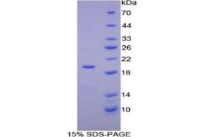 SDS-PAGE analysis of Human ENPP1 Protein. (ENPP1 Protéine)