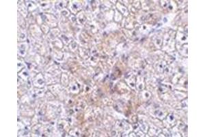 Immunohistochemistry of TRAF2 in human liver tissue with this product at 2. (TRAF2 anticorps  (N-Term))