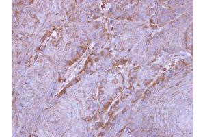 IHC-P Image Immunohistochemical analysis of paraffin-embedded Cal27 xenograft, using SIRT3, antibody at 1:500 dilution.