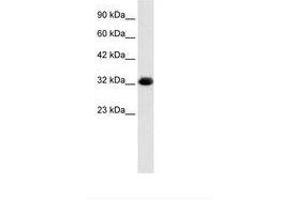 Image no. 1 for anti-Chromosome 22 Open Reading Frame 31 (C22orf31) (AA 113-162) antibody (ABIN202170) (C22orf31 anticorps  (AA 113-162))