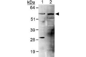 Western blot analysis of PLTP in human (Lane 1) and mouse brain (Lane 2) lysates with PLTP polyclonal antibody . (PLTP anticorps)