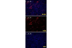 Confocal immunofluorescence analysis of methanol fixed HeLa cells were transfected with pMX construct of human LIN28, cells were analyzed ~62 hours after transfection. (LIN28A anticorps  (AA 93-209))