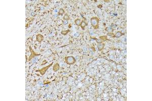 anti-Calcium/calmodulin-Dependent Protein Kinase II beta (CAMK2B) antibody