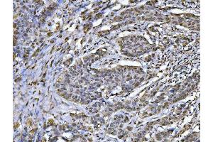 IHC analysis of hnRNP U/p120/HNRNPU using anti-hnRNP U/p120/HNRNPU antibody (ABIN7600979).