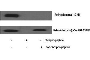 Western Blot (WB) analysis of specific cells using Phospho-Rb (S780) Polyclonal Antibody. (Retinoblastoma 1 anticorps  (pSer780))
