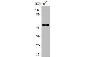 Western Blot analysis of HeLa cells using CREB3L2 Polyclonal Antibody (CREB3L2 anticorps  (Internal Region))