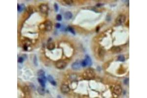 Used in DAB staining on fromalin fixed paraffin-embedded Kidney tissue (UCHL5 anticorps  (AA 2-316))