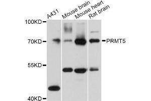 Western blot analysis of extracts of various cell lines, using PRMT5 Antibody (ABIN5970714) at 1:3000 dilution. (PRMT5 anticorps)
