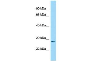 WB Suggested Anti-NUDT7 Antibody Titration: 1. (NUDT7 anticorps  (N-Term))