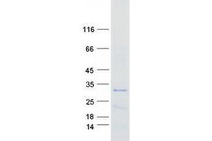 Validation with Western Blot