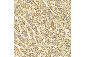 Immunohistochemistry of paraffin-embedded human liver injury using ATP5B antibody.