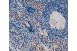 Used in DAB staining on fromalin fixed paraffin- embedded ovary tissue