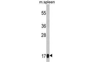 Western blot analysis of RS18 Antibody (Center) Cat. (RPS18 anticorps  (Middle Region))