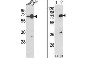 (LEFT) Western blot analysis of HNRPL Antibody (Center) in HepG2, Jurkat cell line lysates (35ug/lane). (HNRNPL anticorps  (Middle Region))