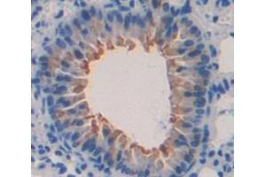 IHC-P analysis of Kidney tissue, with DAB staining. (SLURP1 anticorps  (AA 1-110))
