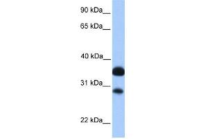 WB Suggested Anti-CITED2 Antibody Titration:  0. (CITED2 anticorps  (N-Term))