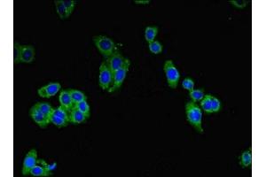 Immunofluorescent analysis of HepG2 cells using ABIN7147039 at dilution of 1:100 and Alexa Fluor 488-congugated AffiniPure Goat Anti-Rabbit IgG(H+L) (Cation Channel Sperm-Associated Protein Subunit epsilon (CATSPERE) (AA 601-832) anticorps)