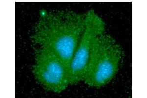 ICC/IF analysis of SGTA in Hep3B cells line, stained with DAPI (Blue) for nucleus staining and monoclonal anti-human SGTA antibody (1:100) with goat anti-mouse IgG-Alexa fluor 488 conjugate (Green).