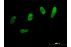 Immunofluorescence of purified MaxPab antibody to SNAI2 on HeLa cell. (SLUG anticorps  (AA 1-268))