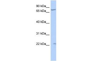 WB Suggested Anti-STRA6 Antibody Titration:  0.