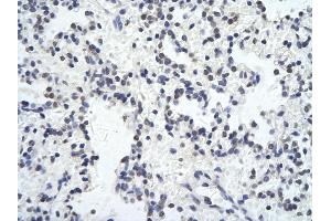 anti-Zinc Finger Protein 652 (ZNF652) (N-Term) antibody