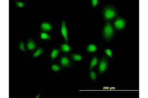 Immunofluorescence of purified MaxPab antibody to MDM4 on HeLa cell. (MDM4-binding Protein anticorps  (AA 1-490))