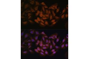Immunofluorescence analysis of U-2 OS cells using CNBP antibody (ABIN7266165) at dilution of 1:100.