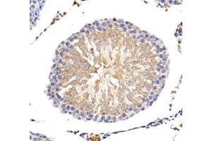 Immunohistochemistry of paraffin embedded mouse lung using MLF1 (ABIN7074712) at dilution of 1: 1500 (400x lens)