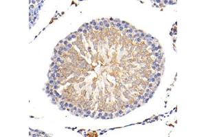 Immunohistochemistry of paraffin embedded mouse lung using MLF1 (ABIN7074712) at dilution of 1: 1500 (400x lens) (MLF1 anticorps)
