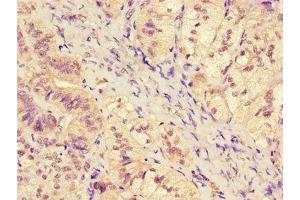 Immunohistochemistry of paraffin-embedded human adrenal gland tissue using ABIN7169176 at dilution of 1:100