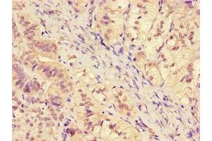 Immunohistochemistry of paraffin-embedded human adrenal gland tissue using ABIN7169176 at dilution of 1:100 (SGK1 anticorps  (AA 247-406))