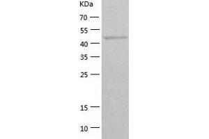 Western Blotting (WB) image for General Transcription Factor IIE, Polypeptide 1, alpha 56kDa (GTF2E1) (AA 1-439) protein (His-IF2DI Tag) (ABIN7123074)
