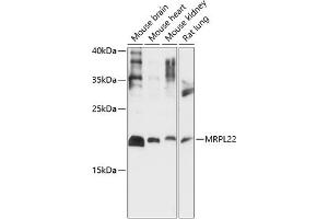 Western blot analysis of extracts of various cell lines, using MRPL22 antibody (ABIN7268563) at 1:1000 dilution. (MRPL22 anticorps  (AA 97-206))