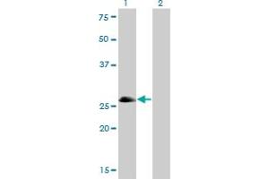 Western Blot analysis of ASCL1 expression in transfected 293T cell line by ASCL1 monoclonal antibody (M01), clone 7E11. (ASCL1 anticorps  (AA 137-236))