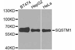 Western blot analysis of extracts of various cell lines, using SQSTM1 antibody. (SQSTM1 anticorps)