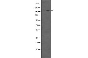 Western blot analysis of EHMT1 expression in ; HepG2 cell lysate,The lane on the left is treated with the antigen-specific peptide. (EHMT1 anticorps  (Internal Region))